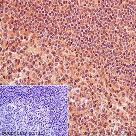 Immunohistochemistry (Formalin/PFA-fixed paraffin-embedded sections) - Anti-Ubiquitin (linkage-specific K63) antibody [EPR8590-448] (AB179434)