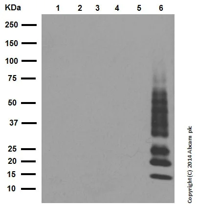 Western blot - Anti-Ubiquitin (linkage-specific K63) antibody [EPR8590-448] (AB179434)