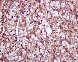 Immunohistochemistry (Formalin/PFA-fixed paraffin-embedded sections) - Anti-Ubiquitin (linkage-specific K63) antibody [EPR8590-448] - Low endotoxin, Azide free (AB220794), expandable thumbnail