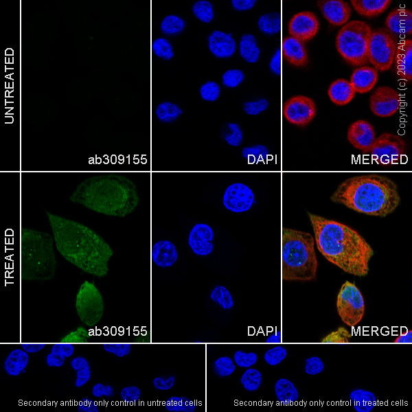 Immunocytochemistry/ Immunofluorescence - Anti-Ubiquitin (phospho S65) antibody [30H3/30K1] (AB309155)