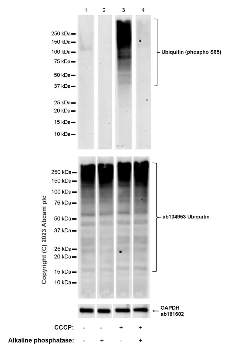 Western blot - Anti-Ubiquitin (phospho S65) antibody [30H3/30K1] (AB309155)