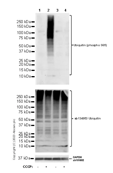 Western blot - Anti-Ubiquitin (phospho S65) antibody [30H3/30K1] (AB309155)