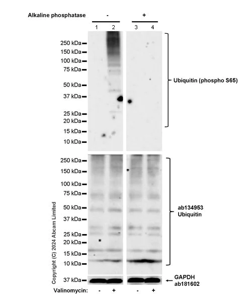 Western blot - Anti-Ubiquitin (phospho S65) antibody [30H3/30K1] - Rat IgG2a (Chimeric) (AB320096)