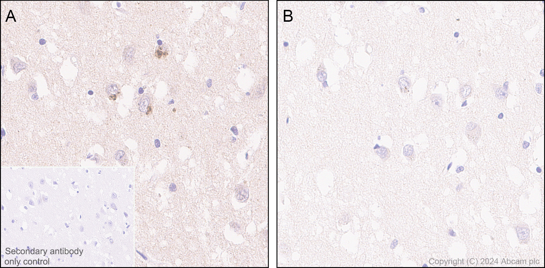 Immunohistochemistry (Formalin/PFA-fixed paraffin-embedded sections) - Anti-Ubiquitin (phospho S65) antibody [41H1/41K3] (AB314903), expandable thumbnail