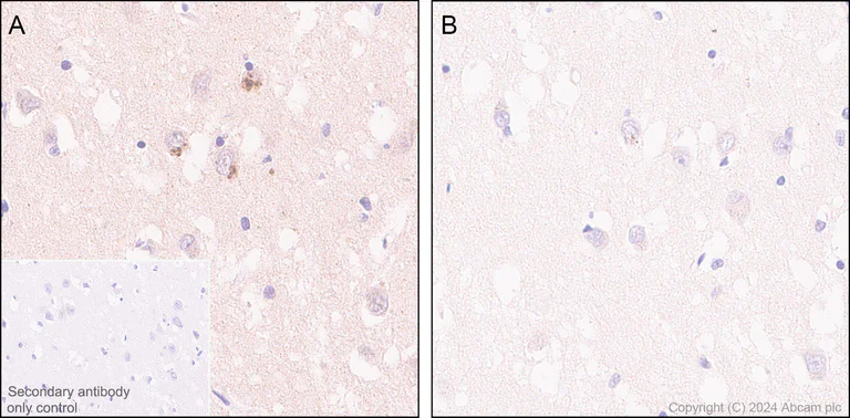 Immunohistochemistry (Formalin/PFA-fixed paraffin-embedded sections) - Anti-Ubiquitin (phospho S65) antibody [41H1/41K3] (AB314903)