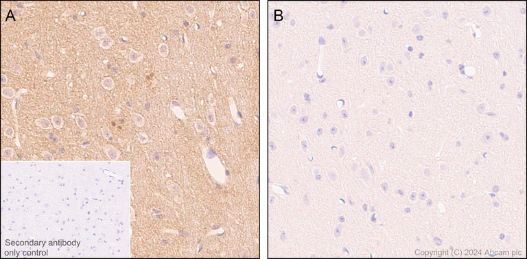 Immunohistochemistry (Formalin/PFA-fixed paraffin-embedded sections) - Anti-Ubiquitin (phospho S65) antibody [41H1/41K3] (AB314903)