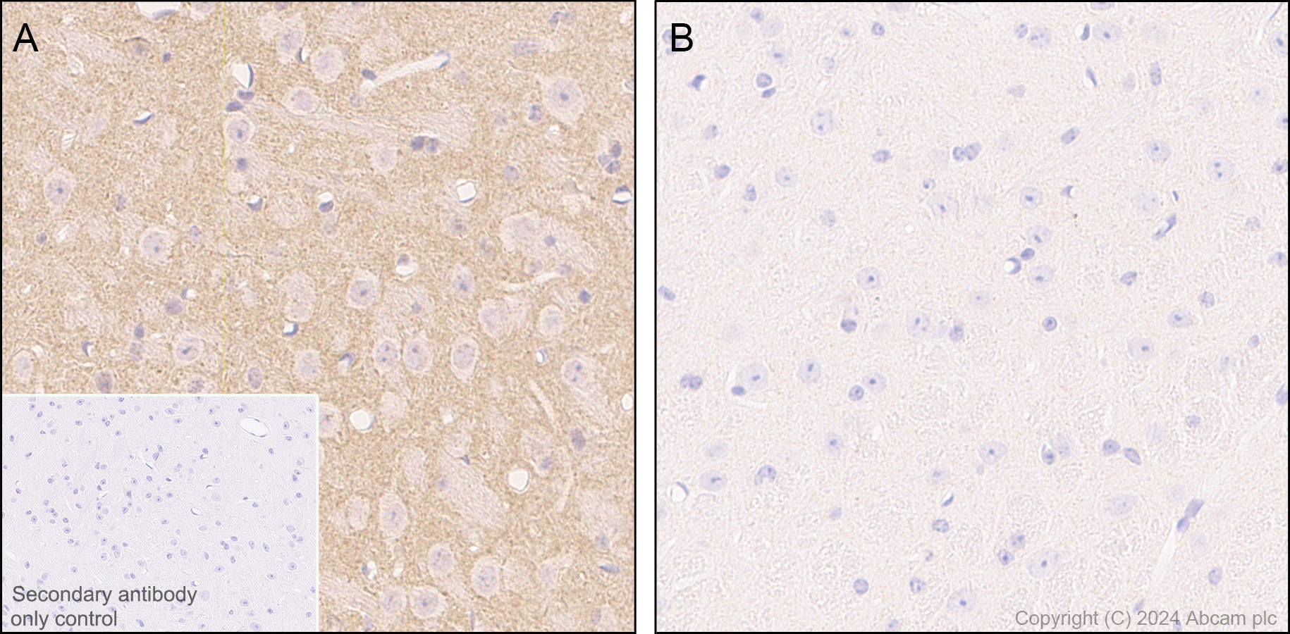 Immunohistochemistry (Formalin/PFA-fixed paraffin-embedded sections) - Anti-Ubiquitin (phospho S65) antibody [41H1/41K3] (AB314903), expandable thumbnail