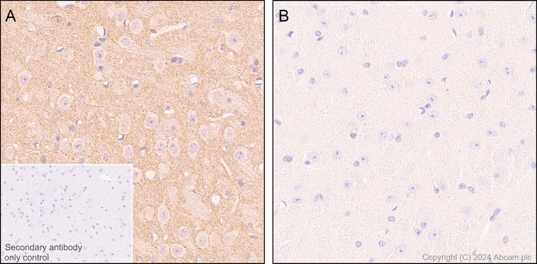 Immunohistochemistry (Formalin/PFA-fixed paraffin-embedded sections) - Anti-Ubiquitin (phospho S65) antibody [41H1/41K3] (AB314903)