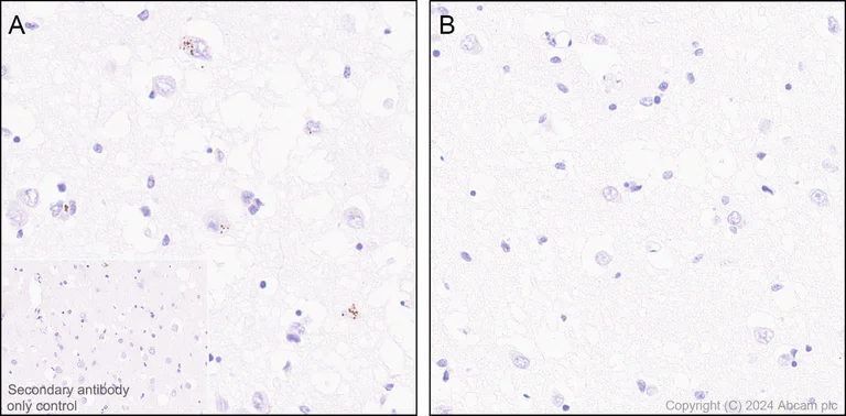 Immunohistochemistry (Formalin/PFA-fixed paraffin-embedded sections) - Anti-Ubiquitin (phospho S65) antibody [41H1/41K3] - Rat IgG2a (Chimeric) - BSA and Azide free (AB318992)