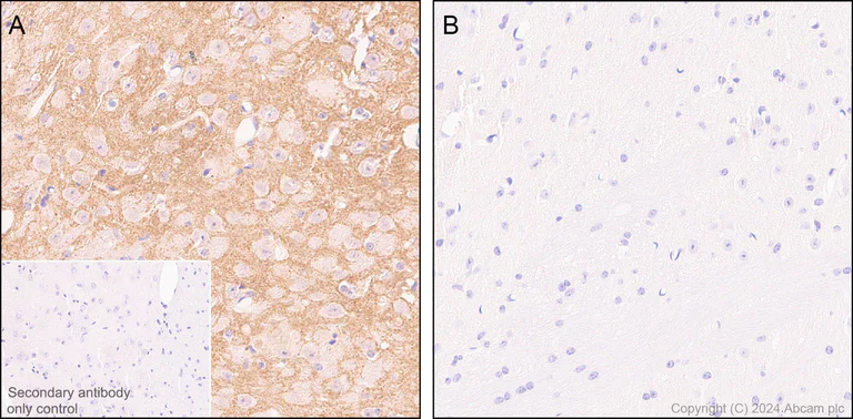 Immunohistochemistry (Formalin/PFA-fixed paraffin-embedded sections) - Anti-Ubiquitin (phospho S65) antibody [41H1/41K3] - Rat IgG2a (Chimeric) - BSA and Azide free (AB318992)