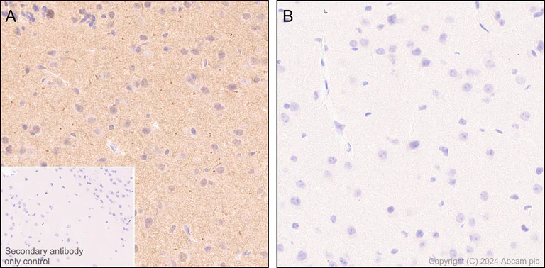 Immunohistochemistry (Formalin/PFA-fixed paraffin-embedded sections) - Anti-Ubiquitin (phospho S65) antibody [41H1/41K3] - Rat IgG2a (Chimeric) - BSA and Azide free (AB318992)