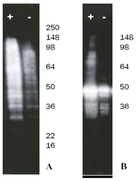 Western blot - Ubiquitylation Assay Kit (HeLa lysate-based) (AB139471), expandable thumbnail
