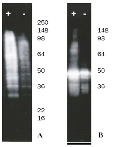 Western blot - Ubiquitylation Assay Kit (HeLa lysate-based) (AB139471)