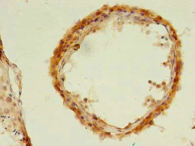 Immunohistochemistry (Formalin/PFA-fixed paraffin-embedded sections) - Anti-UBLCP1 antibody (AB235378)