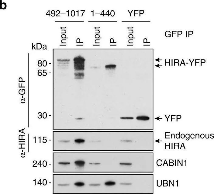 Western blot - Anti-UBN1 antibody (AB101282)