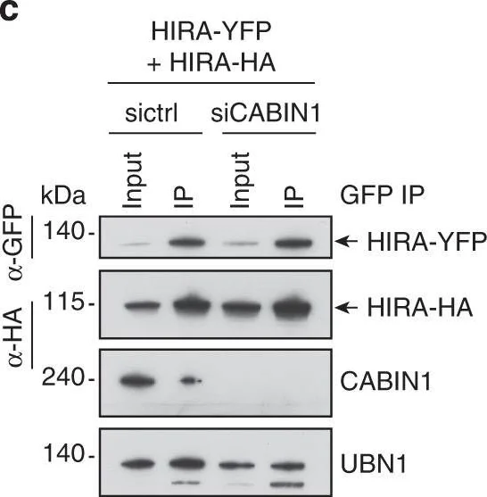 Western blot - Anti-UBN1 antibody (AB101282)