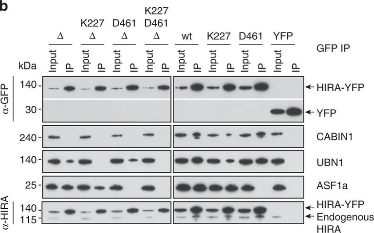 Western blot - Anti-UBN1 antibody (AB101282)