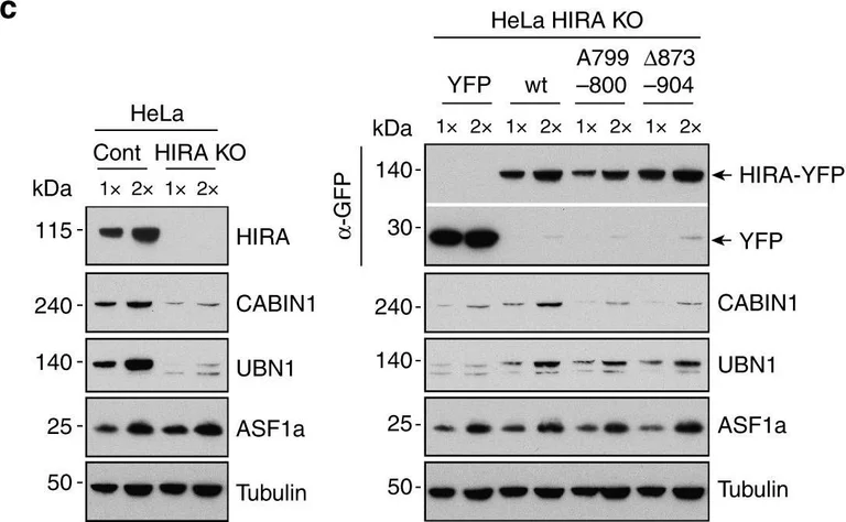 Western blot - Anti-UBN1 antibody (AB101282)