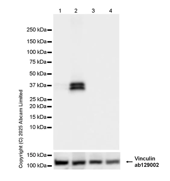 Western blot - Anti-UBP43/USP18 antibody [EPR26174-540] (AB325178)