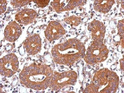 Immunohistochemistry (Formalin/PFA-fixed paraffin-embedded sections) - Anti-UBPY/USP8 antibody (AB228572)