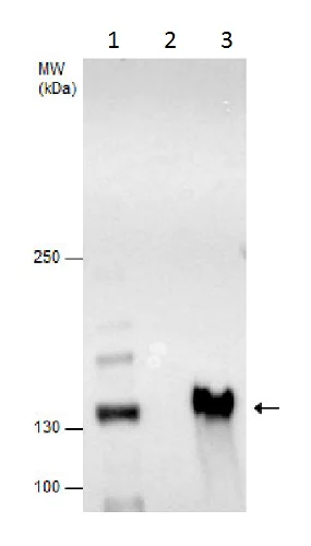 Immunoprecipitation - Anti-UBPY/USP8 antibody (AB228572)