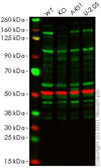 Western blot - Anti-UBPY/USP8 antibody (AB228572)
