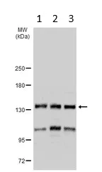 Western blot - Anti-UBPY/USP8 antibody (AB228572)