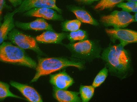 Immunocytochemistry/ Immunofluorescence - Anti-UBQLN2 antibody [6H9] (AB190283)