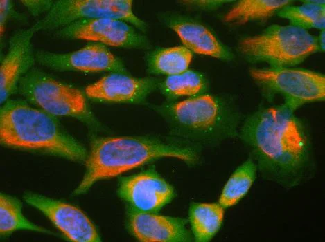 Immunocytochemistry/ Immunofluorescence - Anti-UBQLN2 antibody [6H9] (AB190283)