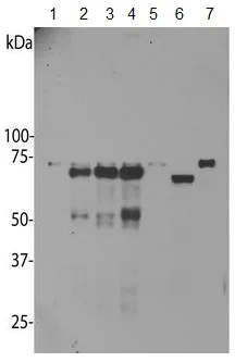 Western blot - Anti-UBQLN2 antibody [6H9] (AB190283)