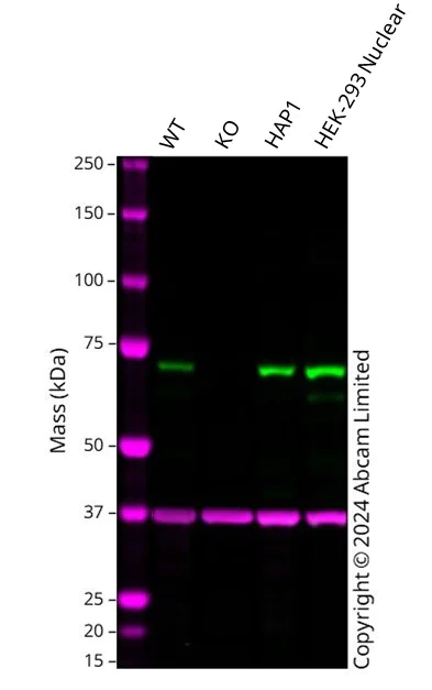 Western blot - Anti-UBQLN2 antibody [6H9] (AB190283)