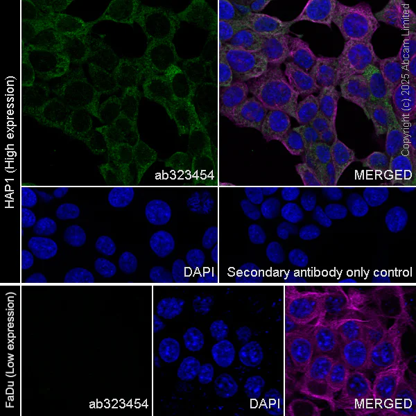Immunocytochemistry/ Immunofluorescence - Anti-UBQLN2 antibody [EPR28592-74] (AB323454)