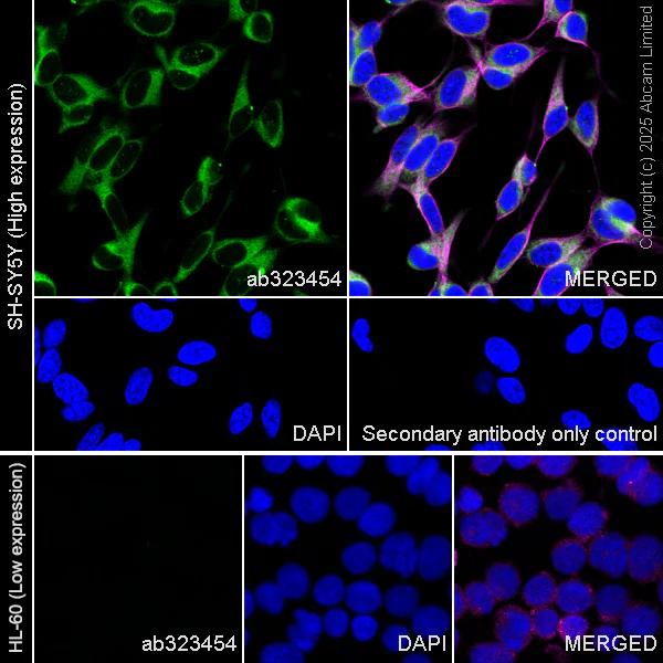 Immunocytochemistry/ Immunofluorescence - Anti-UBQLN2 antibody [EPR28592-74] (AB323454)