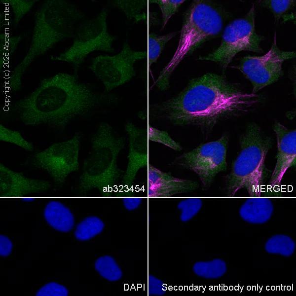 Immunocytochemistry/ Immunofluorescence - Anti-UBQLN2 antibody [EPR28592-74] (AB323454)