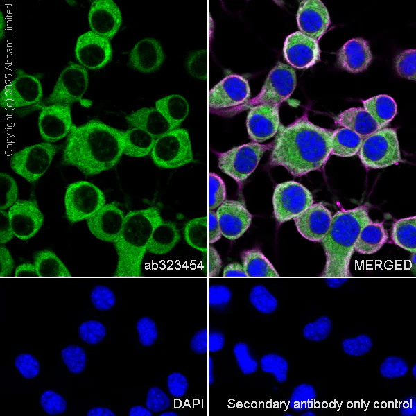 Immunocytochemistry/ Immunofluorescence - Anti-UBQLN2 antibody [EPR28592-74] (AB323454)