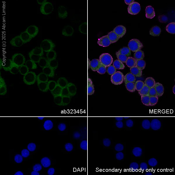 Immunocytochemistry/ Immunofluorescence - Anti-UBQLN2 antibody [EPR28592-74] (AB323454)