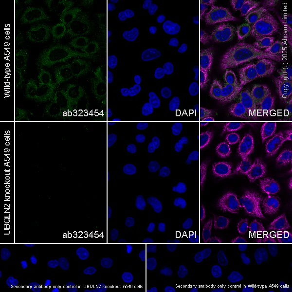 Immunocytochemistry/ Immunofluorescence - Anti-UBQLN2 antibody [EPR28592-74] (AB323454)
