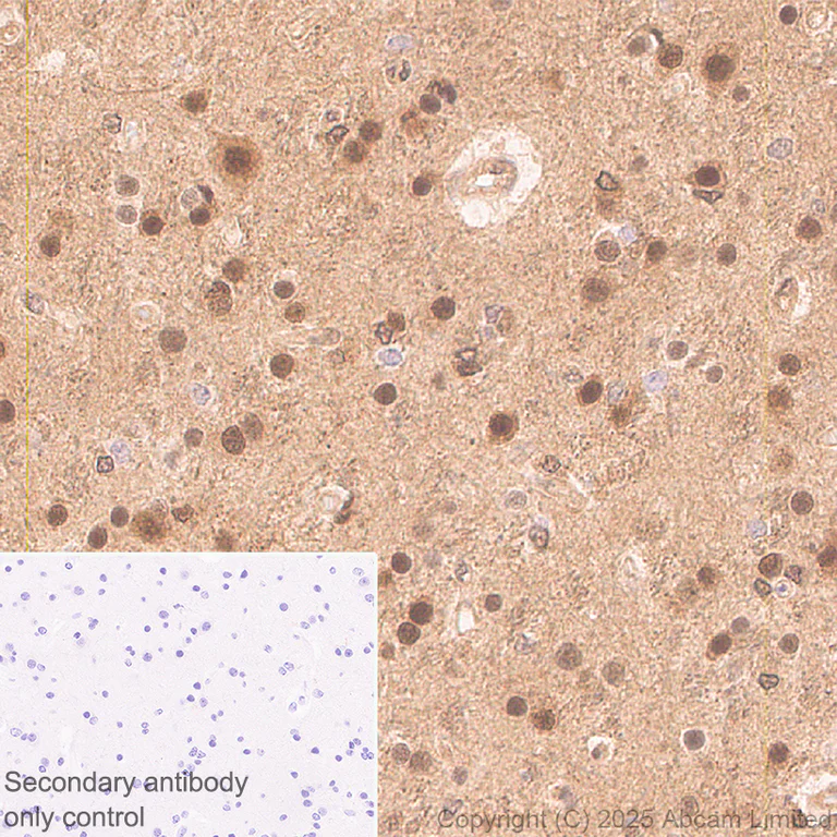 Immunohistochemistry (Formalin/PFA-fixed paraffin-embedded sections) - Anti-UBQLN2 antibody [EPR28592-74] (AB323454)