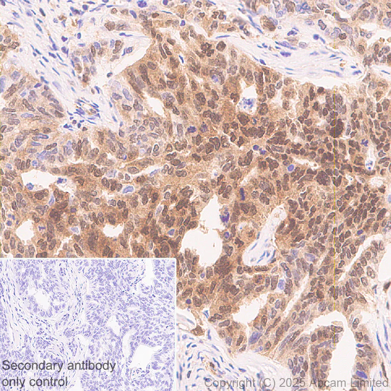 Immunohistochemistry (Formalin/PFA-fixed paraffin-embedded sections) - Anti-UBQLN2 antibody [EPR28592-74] (AB323454)
