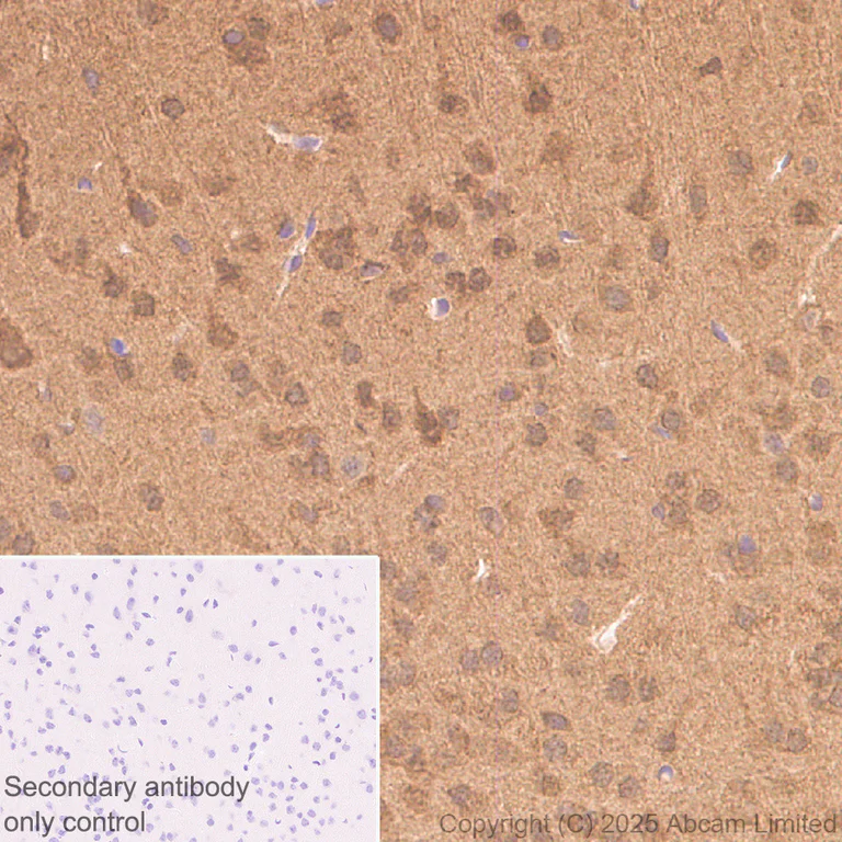 Immunohistochemistry (Formalin/PFA-fixed paraffin-embedded sections) - Anti-UBQLN2 antibody [EPR28592-74] (AB323454)