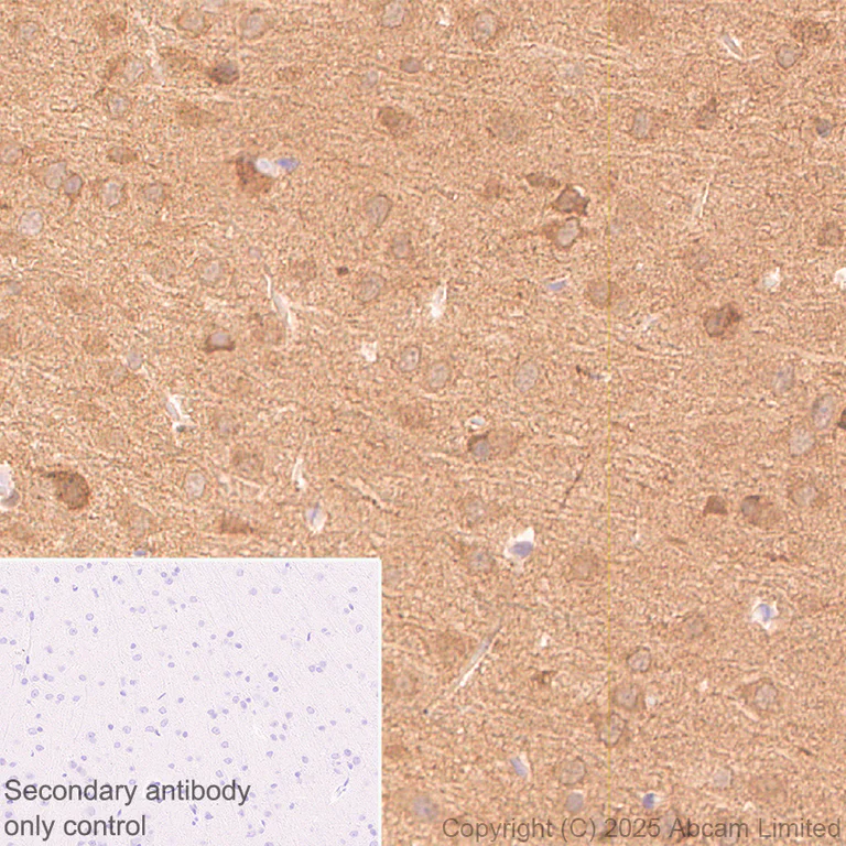 Immunohistochemistry (Formalin/PFA-fixed paraffin-embedded sections) - Anti-UBQLN2 antibody [EPR28592-74] (AB323454)