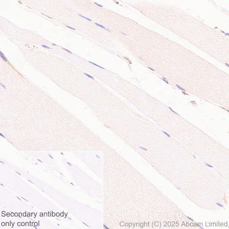 Immunohistochemistry (Formalin/PFA-fixed paraffin-embedded sections) - Anti-UBQLN2 antibody [EPR28592-74] (AB323454)