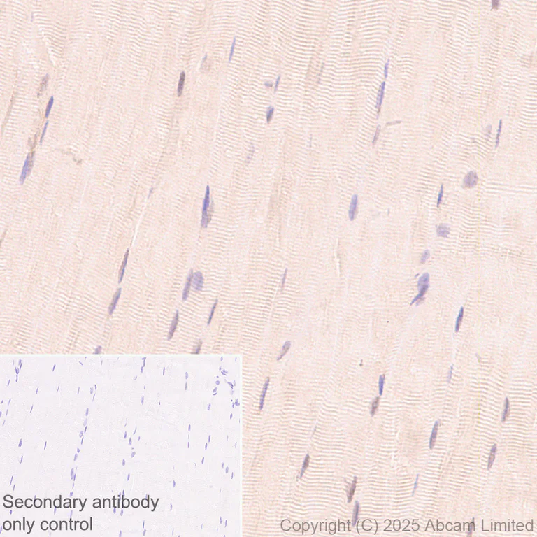 Immunohistochemistry (Formalin/PFA-fixed paraffin-embedded sections) - Anti-UBQLN2 antibody [EPR28592-74] (AB323454)
