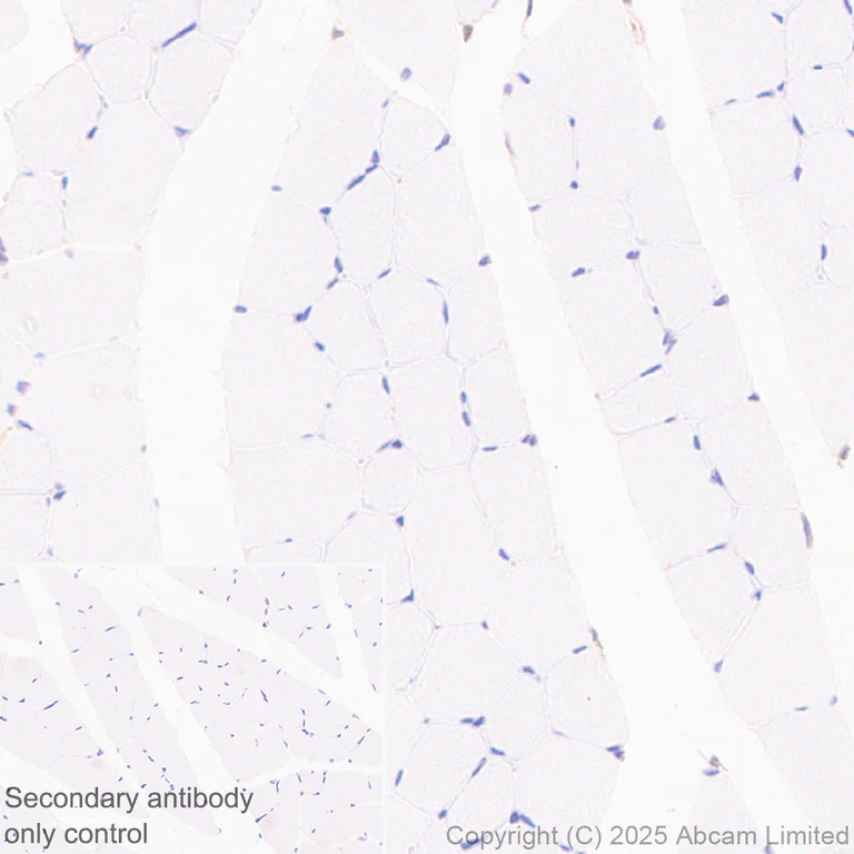 Immunohistochemistry (Formalin/PFA-fixed paraffin-embedded sections) - Anti-UBQLN2 antibody [EPR28592-74] (AB323454)