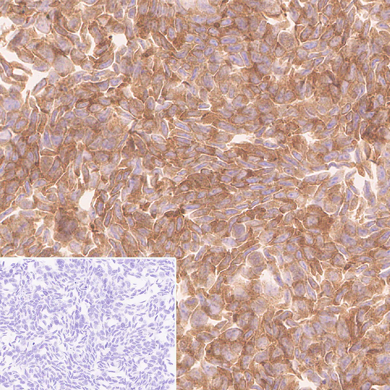 Immunohistochemistry (Formalin/PFA-fixed paraffin-embedded sections) - Anti-UBQLN2 antibody [EPR28592-74] (AB323454)