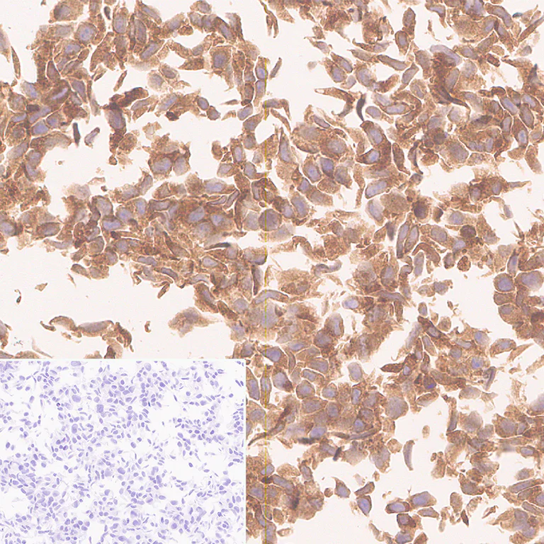 Immunohistochemistry (Formalin/PFA-fixed paraffin-embedded sections) - Anti-UBQLN2 antibody [EPR28592-74] (AB323454)
