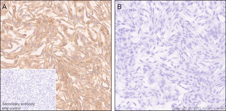 Immunohistochemistry (Formalin/PFA-fixed paraffin-embedded sections) - Anti-UBQLN2 antibody [EPR28592-74] (AB323454)