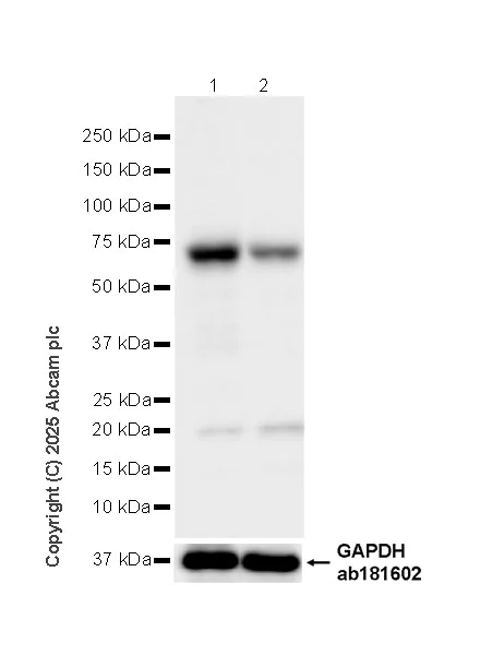 Western blot - Anti-UBQLN2 antibody [EPR28592-74] (AB323454)