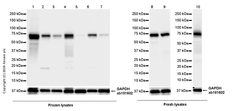 Western blot - Anti-UBQLN2 antibody [EPR28592-74] (AB323454)