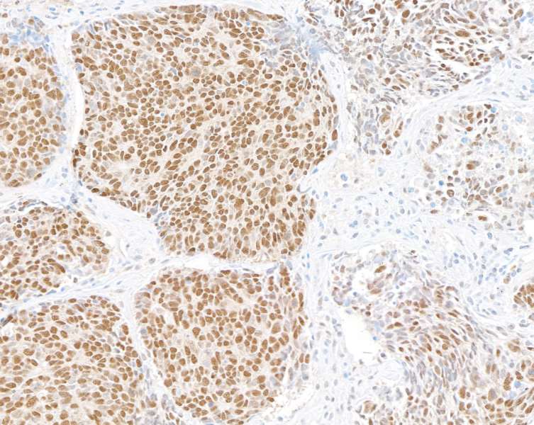 Immunohistochemistry - Anti-UBQLN4/CIP75/Ubiquilin 4 antibody [BLR145J] - BSA free (ab314066), expandable thumbnail